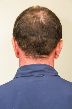 BACK_OF_HEAD-1.jpg